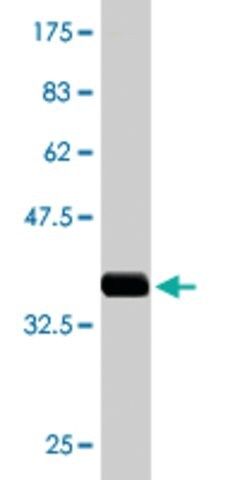 Monoclonal Anti-ALAS2, (N-terminal) antibody produced in mouse