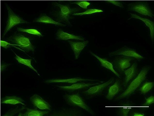 Monoclonal Anti-ALOX15B antibody produced in mouse