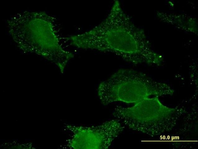 Monoclonal Anti-ALDH9A1 antibody produced in mouse