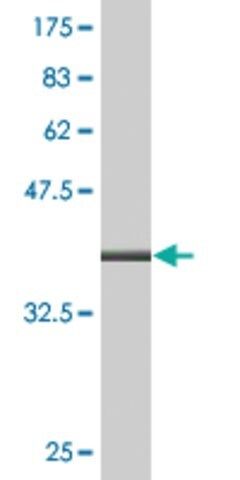 Monoclonal Anti-ALOX12, (C-terminal) antibody produced in mouse