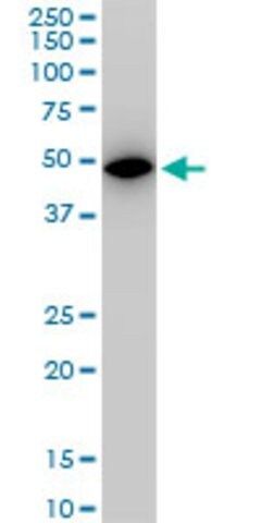 Monoclonal Anti-ALDOA antibody produced in mouse