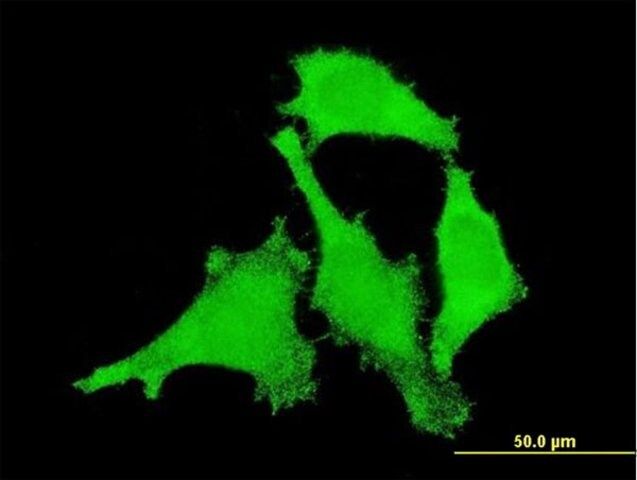 Monoclonal Anti-ANKRD17, (C-terminal) antibody produced in mouse