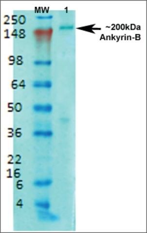 Monoclonal Anti-Ankyrin B-Apc antibody produced in mouse