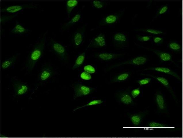 Monoclonal Anti-ANKRD37 antibody produced in mouse