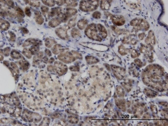 Monoclonal Anti-ASB8, (C-terminal) antibody produced in mouse