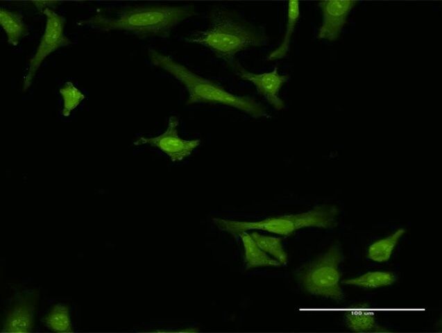 Monoclonal Anti-ARMET antibody produced in mouse