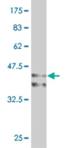 Monoclonal Anti-ARX antibody produced in mouse