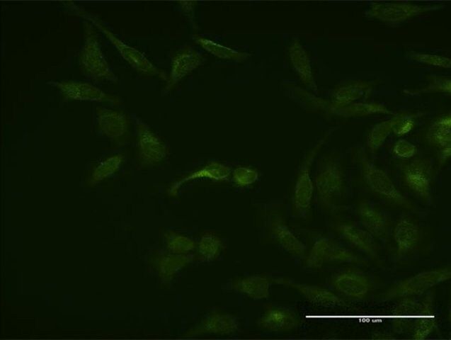 Monoclonal Anti-ASB3 antibody produced in mouse