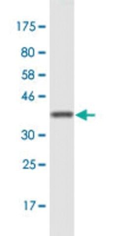 Monoclonal Anti-ASCC2, (C-terminal) antibody produced in mouse