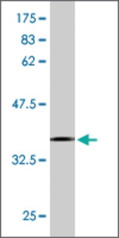 Monoclonal Anti-ASCC2, (C-terminal) antibody produced in mouse