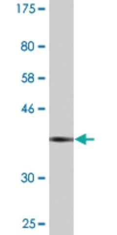 Monoclonal Anti-ARPC5 antibody produced in mouse