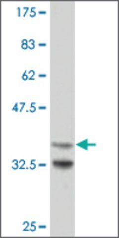 Monoclonal Anti-ARX antibody produced in mouse