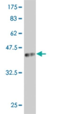 Monoclonal Anti-ARX antibody produced in mouse