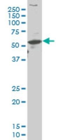 Monoclonal Anti-ARX antibody produced in mouse