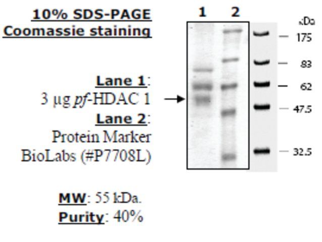 HDAC 1 from <i>Plasmodium falciparum</i>