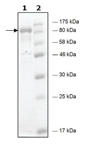 HDAC6 H216A human