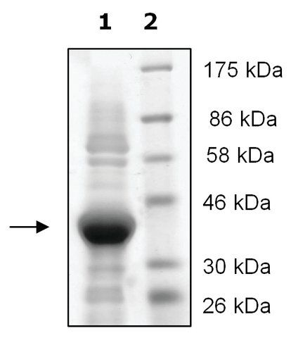 JMJD2A active human