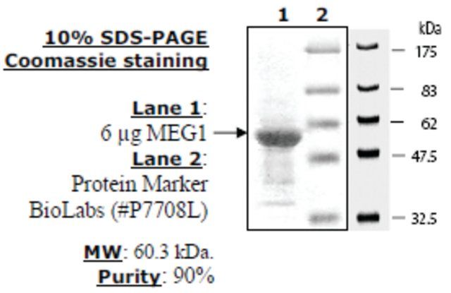 MEG-1 Active human