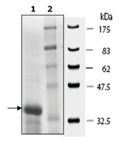 MECP2 human