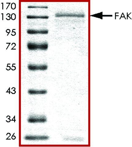 FAK, active, GST tagged human