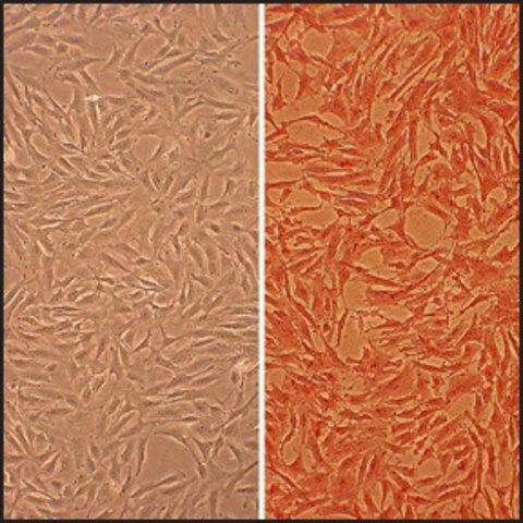 Bovine Coronary Artery Smooth Muscle Cells: BCASMC (Cryovial)