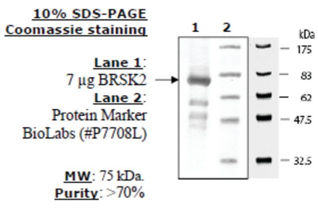 BRSK2 Active human