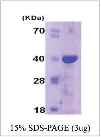 Cyclophilin E human