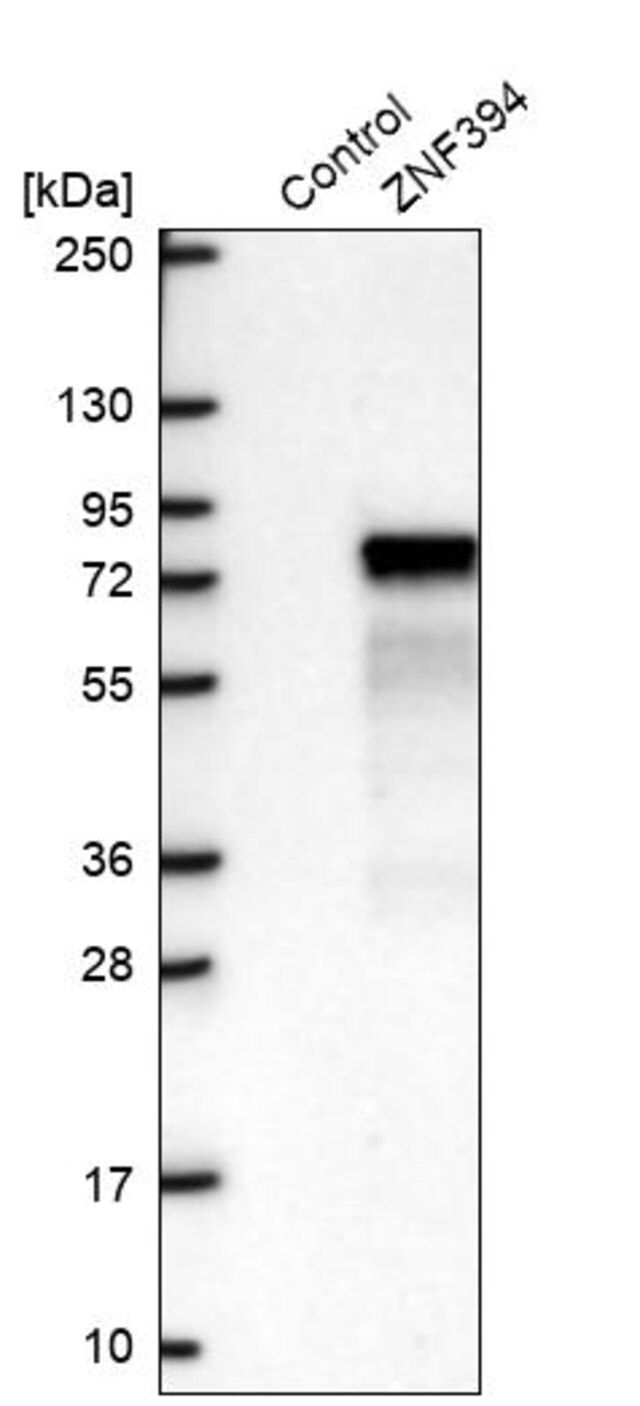 Anti-ZNF394 antibody produced in rabbit