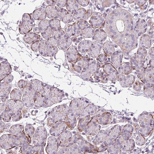 Anti-ZNF197 antibody produced in rabbit