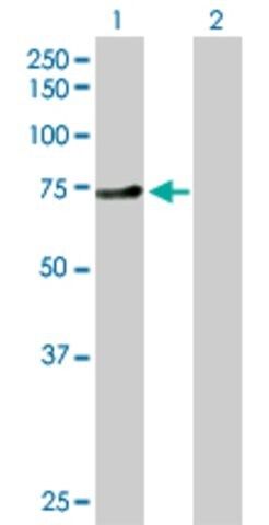 Anti-ZNF394 antibody produced in rabbit