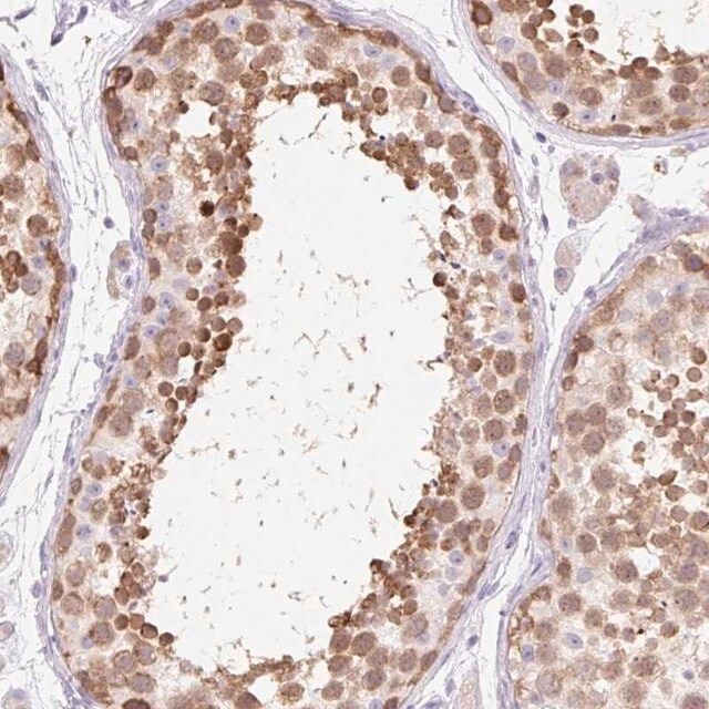 Anti-ZNF121 antibody produced in rabbit