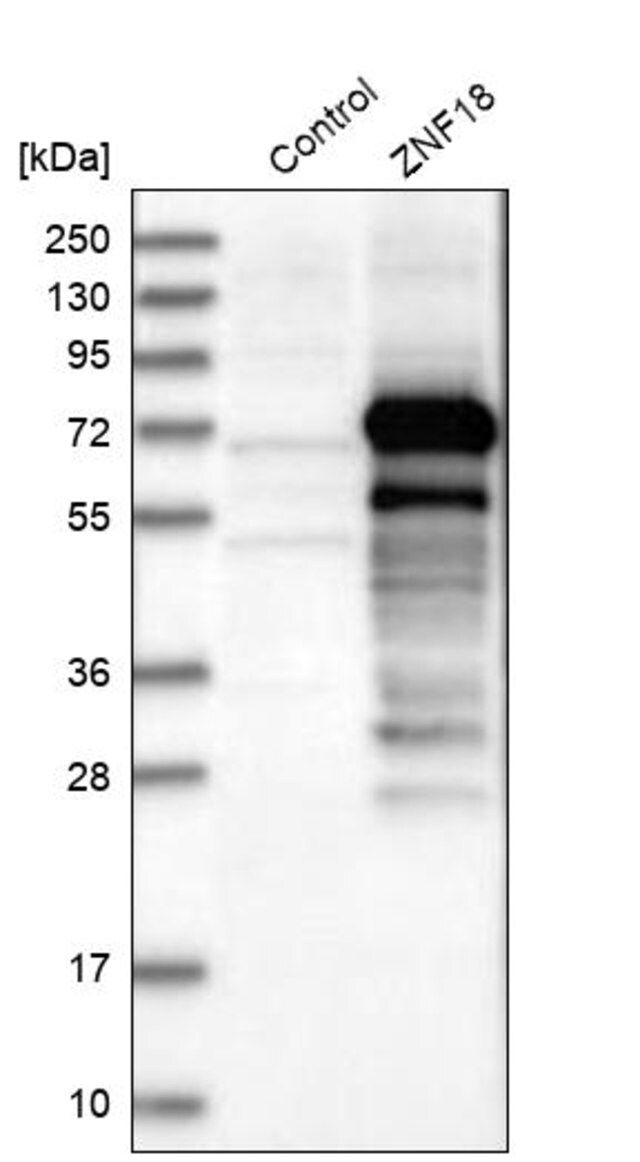 Anti-ZNF18 antibody produced in rabbit