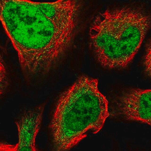 Anti-ZNF281 antibody produced in rabbit