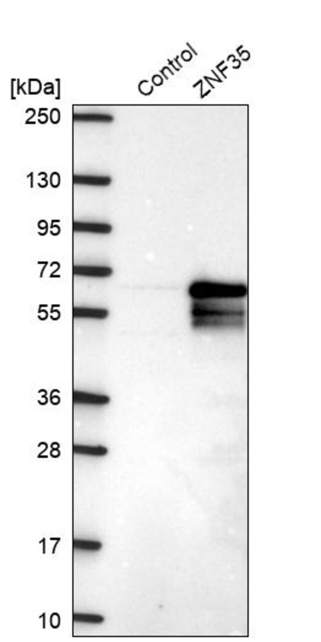 Anti-ZNF35 antibody produced in rabbit