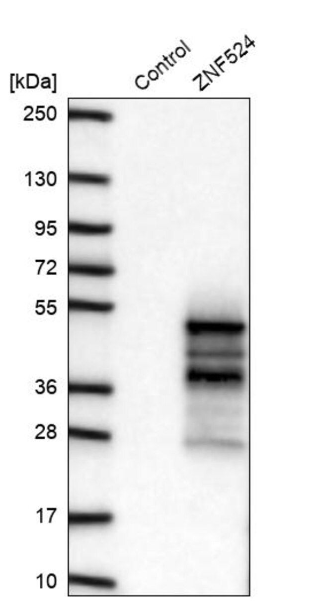 Anti-ZNF524 antibody produced in rabbit