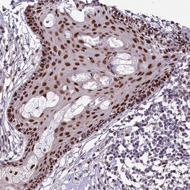 Anti-ZNF707 antibody produced in rabbit