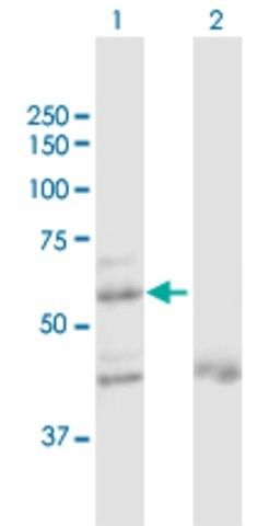 Anti-ZNF92 antibody produced in rabbit