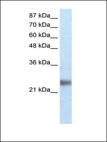 Anti-ZNF313 antibody produced in rabbit