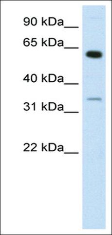 Anti-ZNF609 antibody produced in rabbit