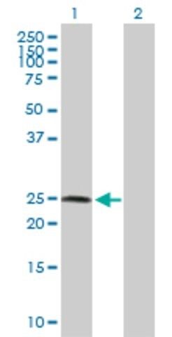 Anti-ZNF313 antibody produced in rabbit