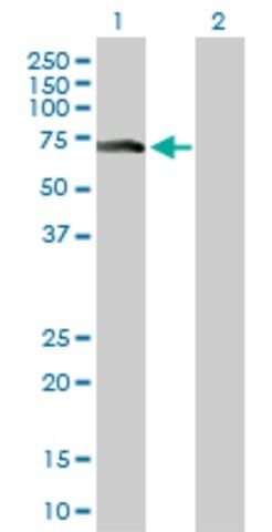 Anti-ZNF18 antibody produced in rabbit