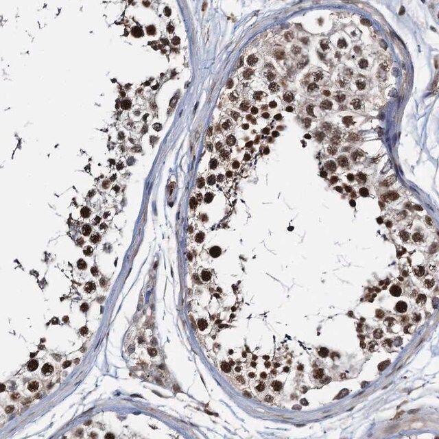 Anti-ZNF609 antibody produced in rabbit