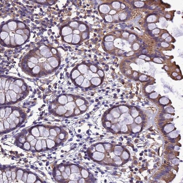 Anti-ZNF235 antibody produced in rabbit