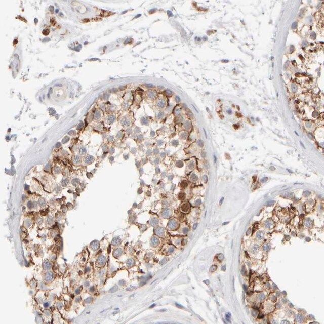 Anti-ZNF112 antibody produced in rabbit