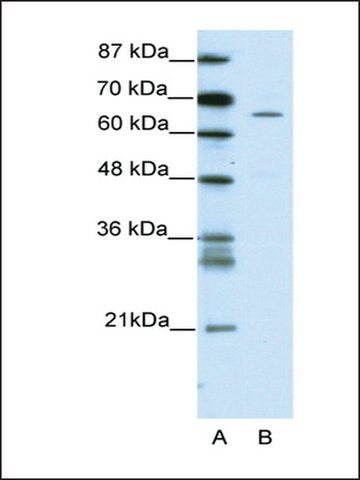 Anti-ZNF205 antibody produced in rabbit