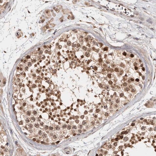 Anti-ZNF83 antibody produced in rabbit