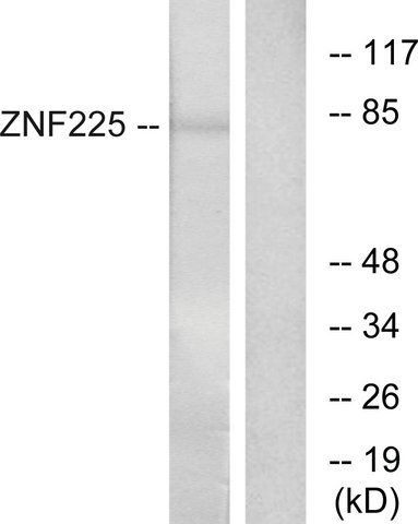 Anti-ZNF225, C-Terminal antibody produced in rabbit