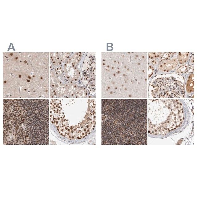 Anti-ZNF830 antibody produced in rabbit