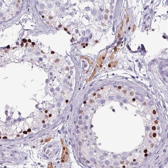 Anti-ZNF816-ZNF321P antibody produced in rabbit