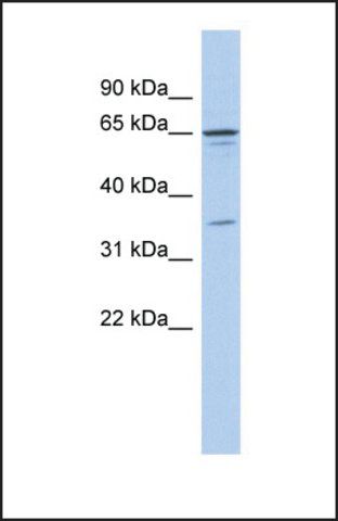 Anti-ZNF648, (N-terminal) antibody produced in rabbit